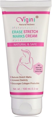 Vigini Anti Stretch Marks Scar Remover Oil Cream During After Pregnancy Delivery Women(100 g)