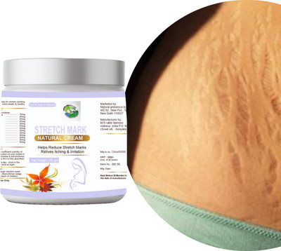 Natural ambience hub Stretch Marks Cream for Reducing Stretch Marks Men & Women(100 g)