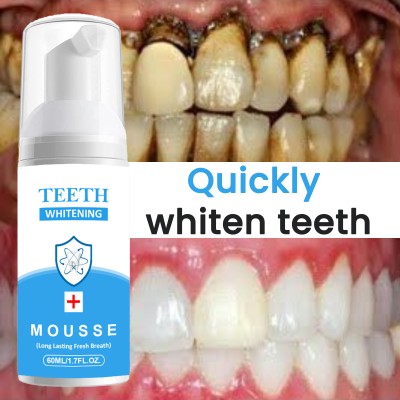 REGLET Teeth Whitening Mousse Foam To Deeply Cleaning Gums, Stain Removal Toothpaste(60 ml)