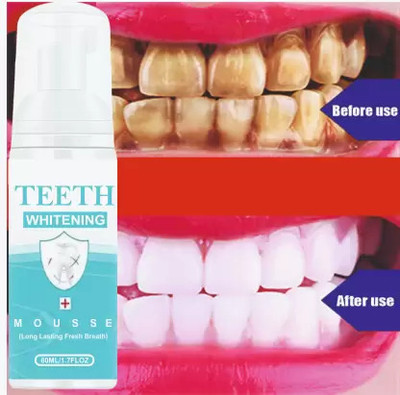 Sthetik Teeth Whitening Foam To Removes Bad Breath Fights Germs Teeth Whitening liquid(60 ml)