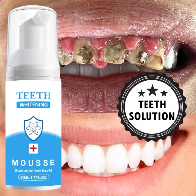 Vishvambhari Teeth Whitening and Mint Cold freshness Effect Liquid Toothpaste Toothpaste(60 ml)