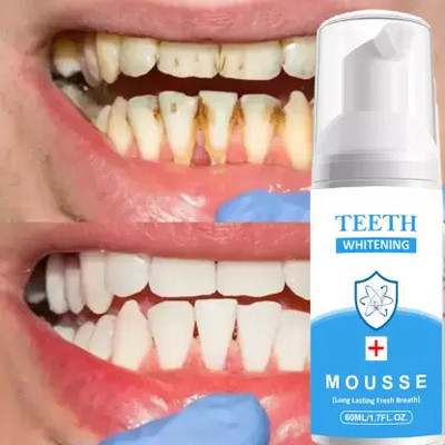Prifakt Teeth Whitening Foam For Fresh Breath and Remove Stains - Fresh Mint Toothpaste(60 ml)