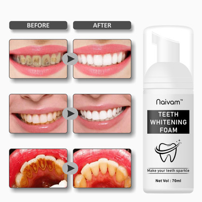 Naivam Teeth Whitening Mousse Foam` Toothpaste(70 ml)