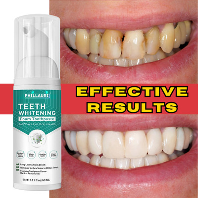 Phillauri Teeth Whitening Foam To Remove Yellow Stains | Teeth Whitening Liquid Toothpaste(60 ml)