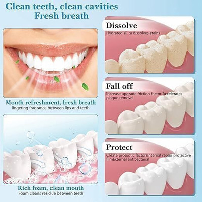 VVD SP-4 Ultra Whitening Toothpaste – Strengthens Enamel & Removes Yellowing Toothpaste(100 g)