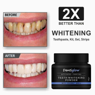 Dentiglow Coconut Shell Charcoal Teeth Whitening Powder - Naturally Whiten Teeth(100 g)