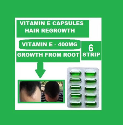 gementis VITAMIN E 400 I.U CAPSULES SPECIFIC FOR HAIRLINE REGAINING (6*10CAPSULES)(6 x 10 Capsules)