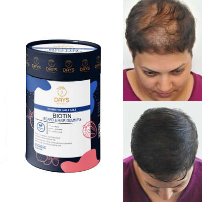 7 Days Hair Gummies for Men | Hair Fall | Dandruff | Hair Regrowth(60 No)