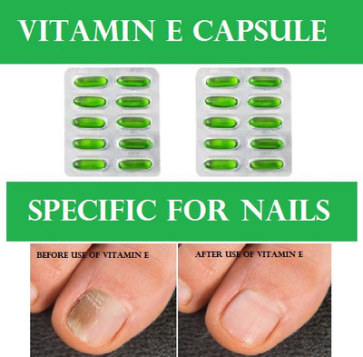 gementis VITAMIN E CAPSULE TREATING THEM AND MAKING THEM LONG AND SMOOTH (2*10CAPS)(2 x 10 Capsules)
