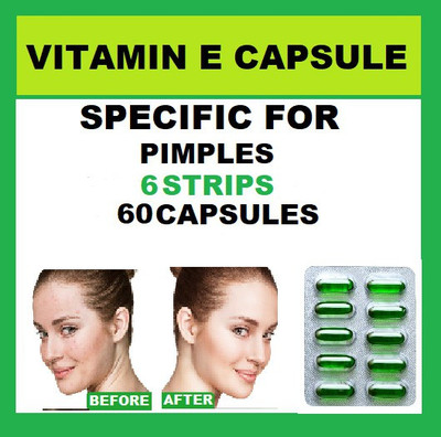 gementis VITAMIN E CAPSULES (400I.U) (6 STRIPS) SPECIFIC FOR PIMPLE TREATMENT(6 x 10 Capsules)