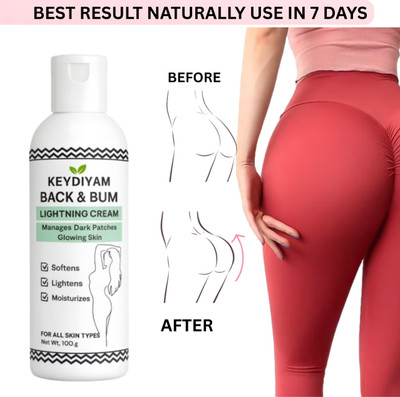 keydiyam BACK & BUMS LIGHNING CREAM Intimate Cream(100 ml)
