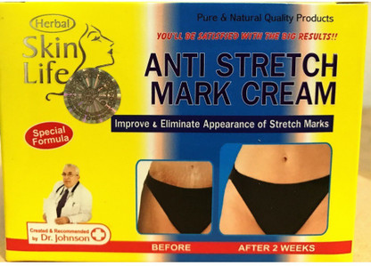 johnson stretch mark cream