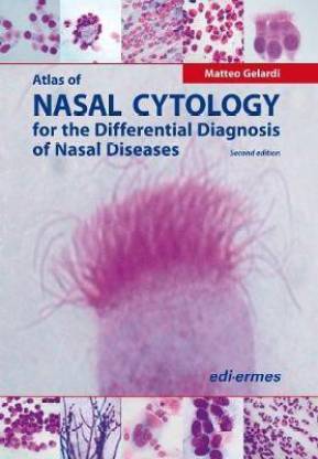 Atlas of Nasal Cytology for the Differential Diagnosis of Nasal Diseases