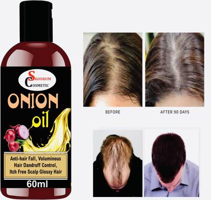 SKOOKUM Onion Oil for Hair Growth with Omega-3; Peppermint & 15 Essential oils Hair Oil - Price in India, Buy SKOOKUM Onion Oil for Hair Growth with Omega-3; Peppermint & 15 Essential SKOOKUM Onion Oil for Hair Growth with Omega-3; Peppermint & 15 Essential oils Hair Oil - Price in India, Buy SKOOKUM Onion Oil for Hair Growth with Omega-3; Peppermint & 15 Essential