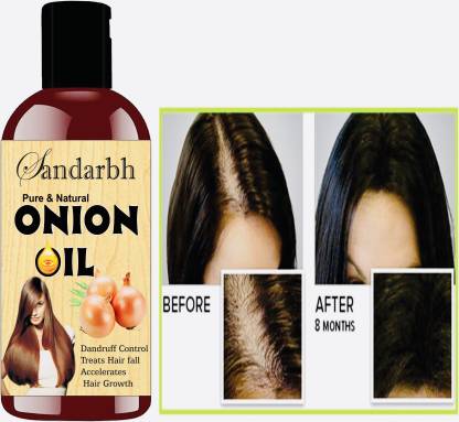 Sandarbh ONION BLACK SEED - HAIR CARE|GROWTH & SHINE|TEA TREE OIL|OMEGA- 3|VITAMIN-E  Hair Oil - Price in India, Buy Sandarbh ONION BLACK SEED - HAIR CARE|GROWTH  & SHINE|TEA TREE OIL|OMEGA- 3|VITAMIN-E Hair