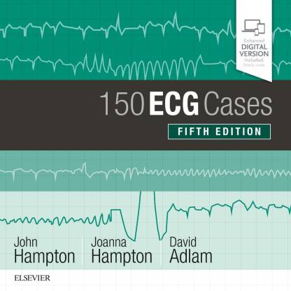 150 ECG Cases: Buy 150 ECG Cases by Hampton John MD, MA, BM BCh, FRCP ...