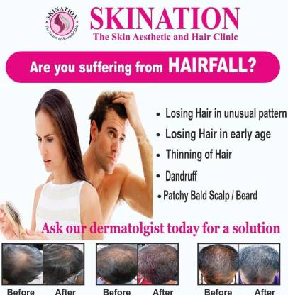 Hair Solution - Falling - Transplant Wall Poster Clinic Poster 12 X 18  Inches Paper Print - Educational posters in India - Buy art, film, design,  movie, music, nature and educational paintings/wallpapers at 