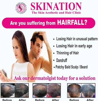 Hair Solution - Falling - Transplant Wall Poster Clinic Poster 12 X 18 Inches Paper Print - Educational posters in India - Buy art, film, design, movie, music, nature and educational paintings/wallpapers at Hair Solution - Falling - Transplant Wall Poster Clinic Poster 12 X 18 Inches Paper Print - Educational posters in India - Buy art, film, design, movie, music, nature and educational paintings/wallpapers at