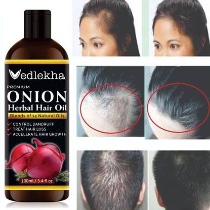 Vedlekha Onion Hair Oil with 14 Essential Oils for Hair Regrowth, Dandruff Control Hair Oil- Hair Oil - Price in India, Buy Vedlekha Onion Hair Oil with 14 Essential Oils for Hair Vedlekha Onion Hair Oil with 14 Essential Oils for Hair Regrowth, Dandruff Control Hair Oil- Hair Oil - Price in India, Buy Vedlekha Onion Hair Oil with 14 Essential Oils for Hair