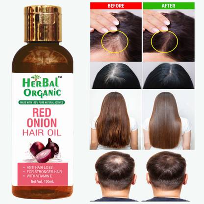 Herbal Organic Onion Hair Oil for Hair Growth, Hair Fall & Dandruff Control Hair Oil, Hair Problem Solution Men & Women. Hair Oil - Price in India, Buy Herbal Organic Onion Hair Herbal Organic Onion Hair Oil for Hair Growth, Hair Fall & Dandruff Control Hair Oil, Hair Problem Solution Men & Women. Hair Oil - Price in India, Buy Herbal Organic Onion Hair