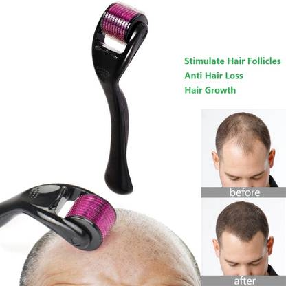 INGOSTORES Marks Derma Roller Beard Activator & Hair Regrowth Micro Needling - Price in India, Buy INGOSTORES Marks Derma Roller Beard Activator & Hair Regrowth Micro Needling Online In India, INGOSTORES Marks Derma Roller Beard Activator & Hair Regrowth Micro Needling - Price in India, Buy INGOSTORES Marks Derma Roller Beard Activator & Hair Regrowth Micro Needling Online In India,