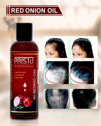 Pristu Onion Hair Oil with 14 Essential Oils for Hair Regrowth, Dandruff Control Hair Oil - Price in India, Buy Pristu Onion Hair Oil with 14 Essential Oils for Hair Regrowth, Dandruff Pristu Onion Hair Oil with 14 Essential Oils for Hair Regrowth, Dandruff Control Hair Oil - Price in India, Buy Pristu Onion Hair Oil with 14 Essential Oils for Hair Regrowth, Dandruff