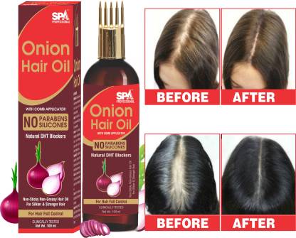 SPA Professionals Onion Hair Oil With Vitamin E Oil For Hair Fall Control With Hair Oil Applicator Natural Oil, Green Tea For Hair Fall Control – 100 Ml Hair Oil  (100 ml)