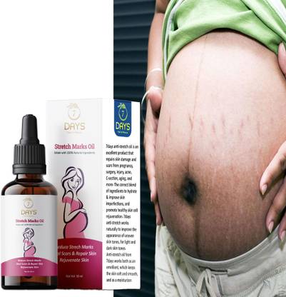 7 Days stretch mark removal oil during pregnancy best cream ...