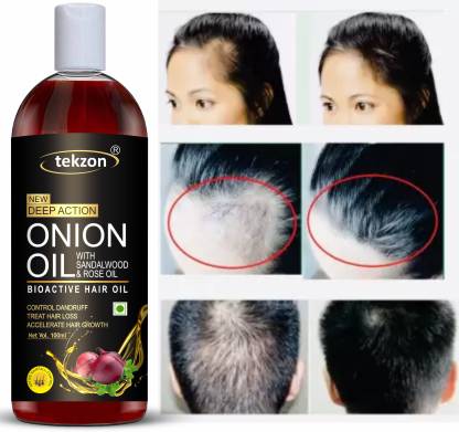 tekzon Bioactive Onion Hair Oil for Control Dandruff, Accelerate Hair  Growth Hair Oil - Price in India, Buy tekzon Bioactive Onion Hair Oil for  Control Dandruff, Accelerate Hair Growth Hair Oil Online