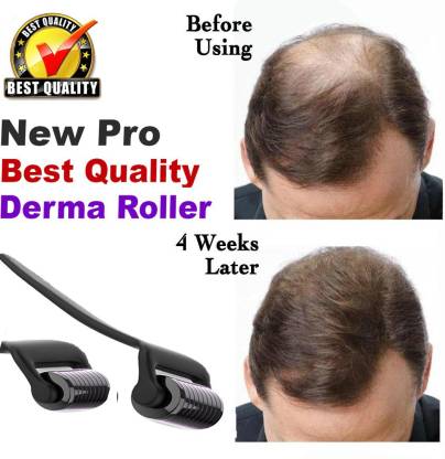 Ayurgenharbal Hair growth Treatment hair derma roller  mm for hair growth  Product - Price in India, Buy Ayurgenharbal Hair growth Treatment hair  derma roller  mm for hair growth Product Online
