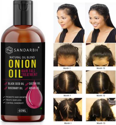 Sandarbh Herbal Premium quality hair oil for hair Regrowth - hair fall control Hair Oil - Price in India, Buy Sandarbh Herbal Premium quality hair oil for hair Regrowth - hair fall Sandarbh Herbal Premium quality hair oil for hair Regrowth - hair fall control Hair Oil - Price in India, Buy Sandarbh Herbal Premium quality hair oil for hair Regrowth - hair fall