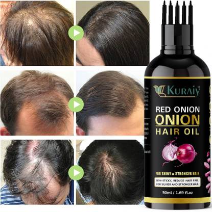 kuraiy Onion Hair Oil With Black Seed Oil Extracts - Controls Hair Fall Hair  Oil - Price in India, Buy kuraiy Onion Hair Oil With Black Seed Oil  Extracts - Controls Hair