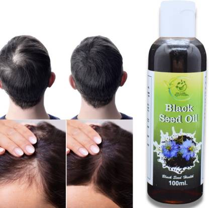 wecureayurveda Black Seed Oil Organic Kalonji for Healthy Skin Hair 100 ML  Hair Oil - Price in India, Buy wecureayurveda Black Seed Oil Organic  Kalonji for Healthy Skin Hair 100 ML Hair