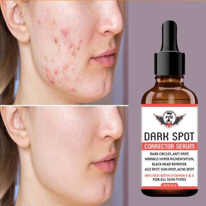 7 Fox Dark Spot Remover Serum Brightening Lightening Pimple Marks Acne Scars Price In India Buy 7 Fox Dark Spot Remover Serum Brightening Lightening Pimple