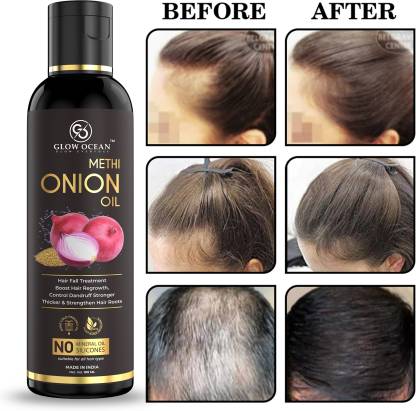 glowocean Onion Methi Hair oil For Hair Fall Control, Hair Growth & Hair  Regrowth Hair Oil - Price in India, Buy glowocean Onion Methi Hair oil For Hair  Fall Control, Hair Growth