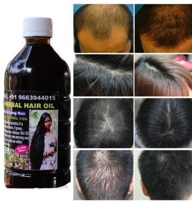 Adivasi yurvedic strong roots oil, privents hair fall good for hair growth Hair Oil - Price in India, Buy Adivasi yurvedic strong roots oil, privents hair fall good for hair growth Hair Adivasi yurvedic strong roots oil, privents hair fall good for hair growth Hair Oil - Price in India, Buy Adivasi yurvedic strong roots oil, privents hair fall good for hair growth Hair