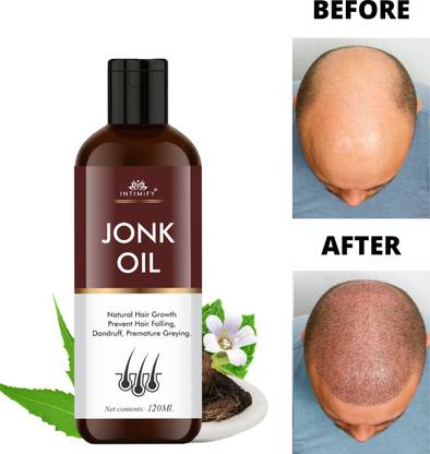 INTIMIFY Leech Oil (Jonk Oil) For Hair Growth Oil Men & Women, Anti Dandruff, Hair Fall Hair Oil - Price in India, Buy INTIMIFY Leech Oil (Jonk Oil) For Hair Growth Oil INTIMIFY Leech Oil (Jonk Oil) For Hair Growth Oil Men & Women, Anti Dandruff, Hair Fall Hair Oil - Price in India, Buy INTIMIFY Leech Oil (Jonk Oil) For Hair Growth Oil