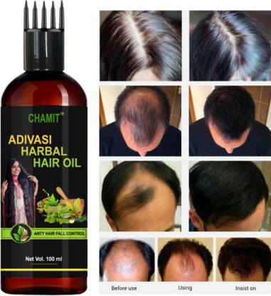 Chamit 2x Faster New Designer Herbal Hair Growth Oil in 100% Natural  Ingredients Hair Oil - Price in India, Buy Chamit 2x Faster New Designer  Herbal Hair Growth Oil in 100% Natural