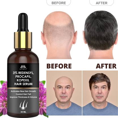 INTIMIFY 3% Redensyl Hair Growth Serum For Hair Fall Control, Delays Hair Greying 30 ml Hair Oil - Price in India, Buy INTIMIFY 3% Redensyl Hair Growth Serum For Hair Fall Control, INTIMIFY 3% Redensyl Hair Growth Serum For Hair Fall Control, Delays Hair Greying 30 ml Hair Oil - Price in India, Buy INTIMIFY 3% Redensyl Hair Growth Serum For Hair Fall Control,
