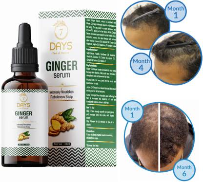 7 Days Ginger Hair Oil - Price in India, Buy 7 Days Ginger Hair Oil Online  In India, Reviews, Ratings & Features 