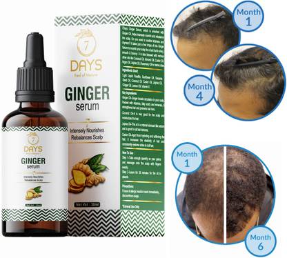 7 Days Ginger Hair Oil - Price in India, Buy 7 Days Ginger Hair Oil Online In India, Reviews, Ratings & Features 7 Days Ginger Hair Oil - Price in India, Buy 7 Days Ginger Hair Oil Online In India, Reviews, Ratings & Features