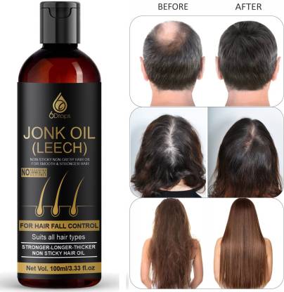 6Drops Leech Oil (Jonk Oil) For Hair Growth Oil Men & Women, Anti Dandruff, Hair  Fall Hair Oil - Price in India, Buy 6Drops Leech Oil (Jonk Oil) For Hair  Growth Oil