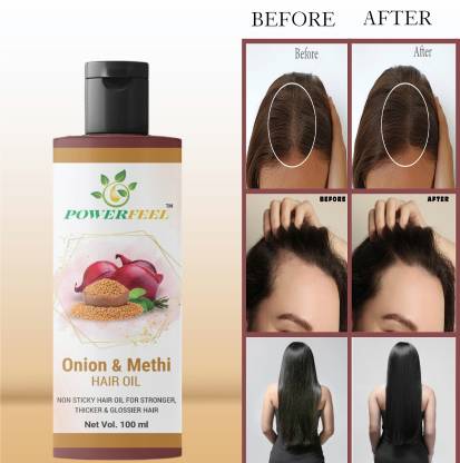 POWERFEEL Onion Methi (Fenugreek) Hair Oil For Hair Growth Hair oil Hair  Oil - Price in India, Buy POWERFEEL Onion Methi (Fenugreek) Hair Oil For Hair  Growth Hair oil Hair Oil Online