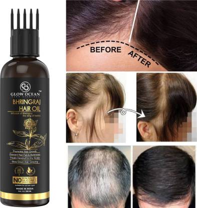 glowocean Bhringraj Hair Oil - For Prevent Hair Fall,Promotes Hair Growth Hair Oil - Price in India, Buy glowocean Bhringraj Hair Oil - For Prevent Hair Fall,Promotes Hair Growth Hair Oil Online glowocean Bhringraj Hair Oil - For Prevent Hair Fall,Promotes Hair Growth Hair Oil - Price in India, Buy glowocean Bhringraj Hair Oil - For Prevent Hair Fall,Promotes Hair Growth Hair Oil Online