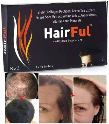 HairFul Biotin Tablets hair fall for hair growth ayurvedic for hair loss  and regrowth - Price in India, Buy HairFul Biotin Tablets hair fall for hair  growth ayurvedic for hair loss and