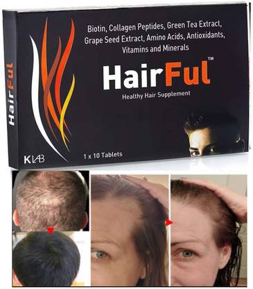 HairFul Biotin Tablets hair fall for hair growth ayurvedic for hair loss and regrowth - Price in India, Buy HairFul Biotin Tablets hair fall for hair growth ayurvedic for hair loss and HairFul Biotin Tablets hair fall for hair growth ayurvedic for hair loss and regrowth - Price in India, Buy HairFul Biotin Tablets hair fall for hair growth ayurvedic for hair loss and