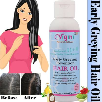 Vigini 100% Natural Actives Anti Premature Early Grey Greying Hair Care  Treatment Oil Control Hair