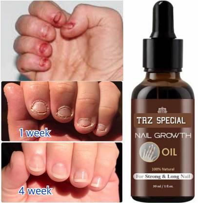 Cemera Nail Oil - For Nail Growth |Long,Strong Nail |Repair Break Nail & Cuticle Care Yellow - Price in India, Buy Cemera Nail Oil - For Nail Growth |Long,Strong Nail |Repair Break Cemera Nail Oil - For Nail Growth |Long,Strong Nail |Repair Break Nail & Cuticle Care Yellow - Price in India, Buy Cemera Nail Oil - For Nail Growth |Long,Strong Nail |Repair Break