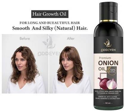 Vitracos Onion Hair Growth Oil with Goodness of Ashwagandha and Hibiscus for Hair Growth Hair Oil Price in India - Buy Vitracos Onion Hair Growth Oil with Goodness of Ashwagandha and Hibiscus Vitracos Onion Hair Growth Oil with Goodness of Ashwagandha and Hibiscus for Hair Growth Hair Oil Price in India - Buy Vitracos Onion Hair Growth Oil with Goodness of Ashwagandha and Hibiscus