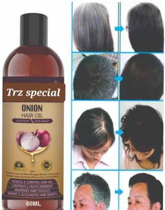 TRZ Grey Hair Solution Oil for Shiny Hair Long - Dandruff - Hair Loss Control Hair Oil Price in India - Buy TRZ Grey Hair Solution Oil for Shiny Hair Long - TRZ Grey Hair Solution Oil for Shiny Hair Long - Dandruff - Hair Loss Control Hair Oil Price in India - Buy TRZ Grey Hair Solution Oil for Shiny Hair Long -